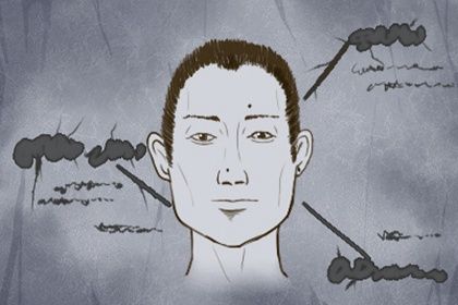 脸上富贵痣长在哪里 龟尾痣则富贵吉祥大吉大利 脸上富贵痣长在哪里 龟尾痣则富贵吉祥大吉大利